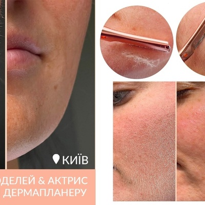 Шукаємо 2 моделi або актриси для зйомки Дерма планнеру | Lemon Agency